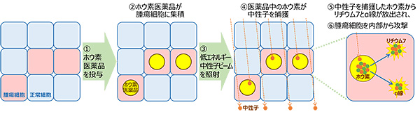 BNCTのイメージ
